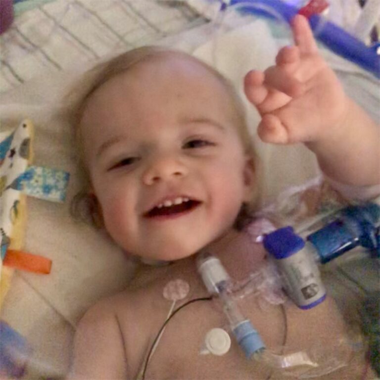 Hudson lying in a hospital bed with a feeding tube